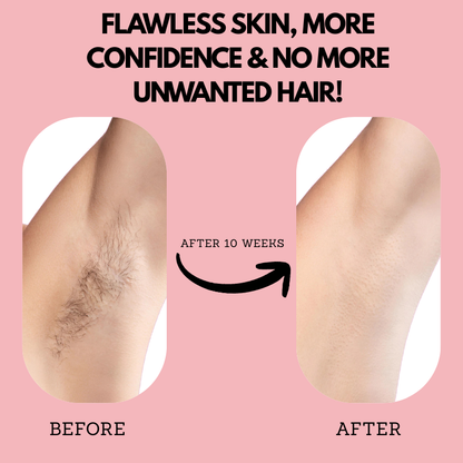 Lureaz™ IPL Hair Remover