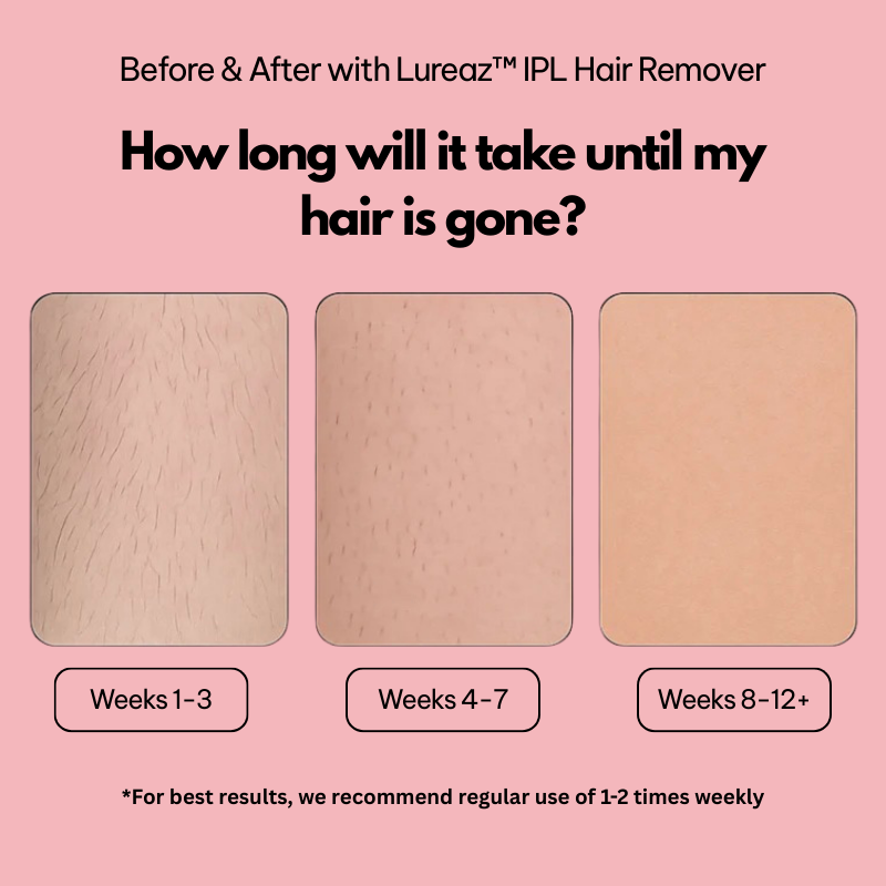 Lureaz™ IPL Hair Remover