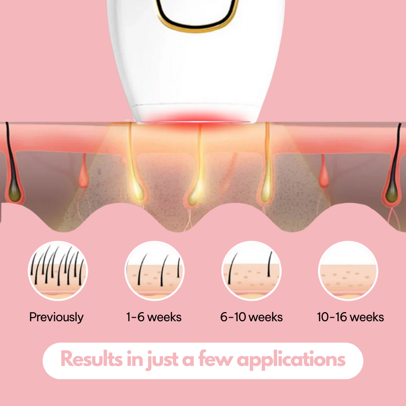 Lureaz™ IPL Hair Remover