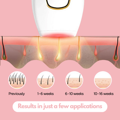 Lureaz™ IPL Hair Remover