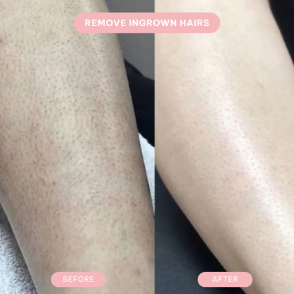 Lureaz™ IPL Hair Remover