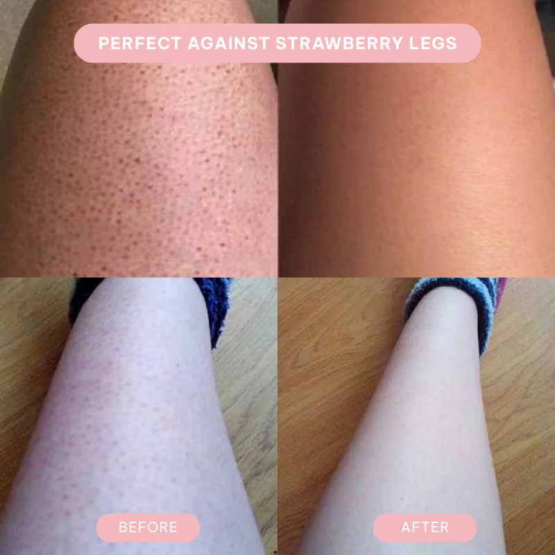 Lureaz™ IPL Hair Remover